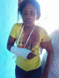 Mujer resulta lesionada tras dos hombres atracarla para despojarla de cell